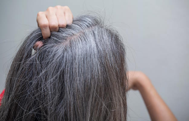 Premature Hair Graying Hair whitening - Palitya